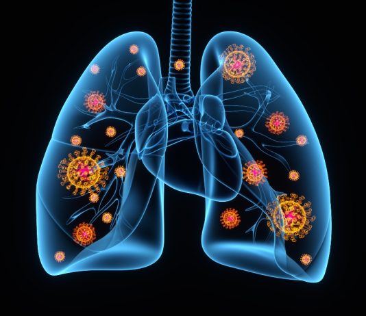 Frig sau mahmureala? Acestea sunt simptomele OMICRON pe care ar trebui sa le cunoasteti